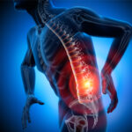 sciatica-pain
