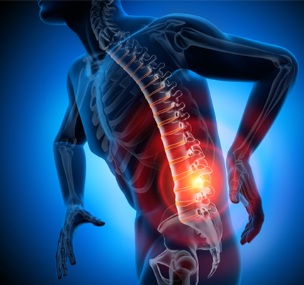 sciatica-pain